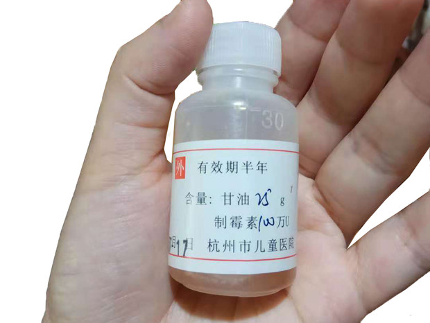 寶寶嘴里長了白色斑點，很可能是鵝口瘡